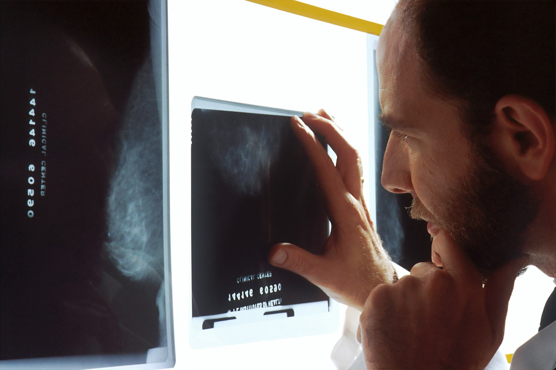 Gerybinė prostatos hiperplazija: simptomai, rizikos veiksniai ir įrodymais pagrįstas valdymas